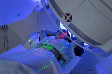 Radiation Therapy para sa Kanser .